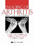 Imaging of Arthritis and Related Conditions - Greenfield, George B, and Arrington, John A, and Vasey, Frank B