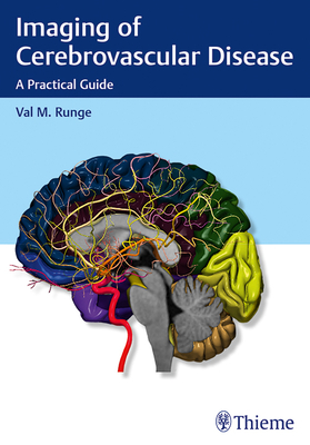 Imaging of Cerebrovascular Disease: A Practical Guide - Runge, Val M