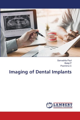 Imaging of Dental Implants - Paul, Samadrita, and P, Balaji, and C, Poornima