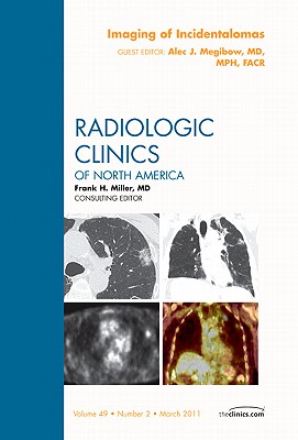 Imaging of Incidentalomas, an Issue of Radiologic Clinics of North America: Volume 49-2 - Megibow, Alec J, MD, MPH, Facr