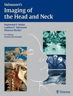 Imaging of the Head and Neck