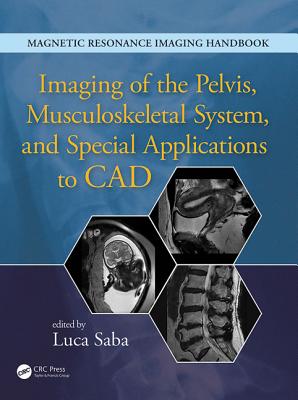 Imaging of the Pelvis, Musculoskeletal System, and Special Applications to CAD - Saba, Luca (Editor)