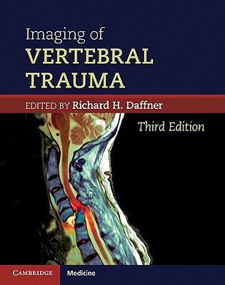 Imaging of Vertebral Trauma - Daffner, Richard H, Dr.