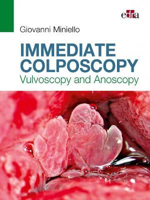 Immediate Colposcopy - Vulvoscopy and Anoscopy - Miniello, Giovanni