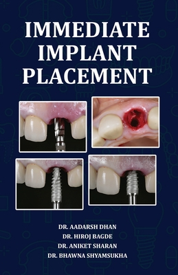 Immediate Implant Placement - Dhan, Aadarsh, Dr.