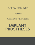 Implant retained Prostheses: Screw versus Cement