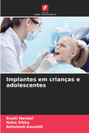 Implantes em crian?as e adolescentes