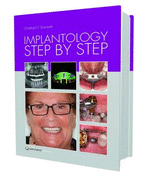 Implantology Step by Step