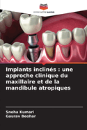 Implants inclin?s: une approche clinique du maxillaire et de la mandibule atropiques