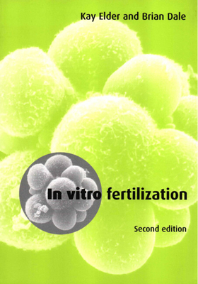 In Vitro Fertilization - Elder, Kay, and Dale, Brian