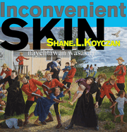 Inconvenient Skin / Nay?ht?wan Wasakay