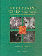 Indocyanine Green Angiography - Flower, Andrew, PhD, and Slakter, Jason S, MD, and Yannuzzi, Lawrence A, MD