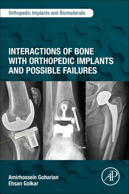 Interactions of Bone with Orthopedic Implants and Possible Failures - Goharian, Amirhossein, and Golkar, Ehsan