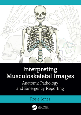Interpreting Musculoskeletal Images: Anatomy, Pathology and Emergency Reporting - Jones, Rosie