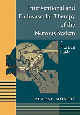 Interventional and Endovascular Therapy of the Nervous System: A Practical Guide - Morris, Pearse
