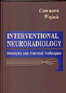 Interventional Neuroradiology: Strategies and Practical Techniques