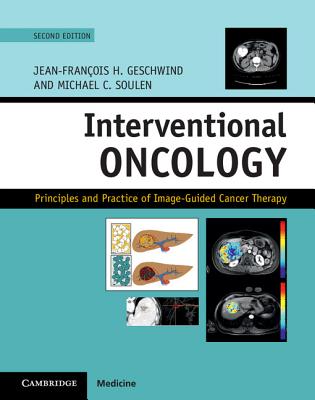 Interventional Oncology: Principles and Practice of Image-Guided Cancer Therapy - Geschwind, Jean-Francois H. (Editor), and Soulen, Michael C. (Editor)