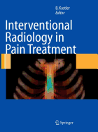 Interventional Radiology in Pain Treatment