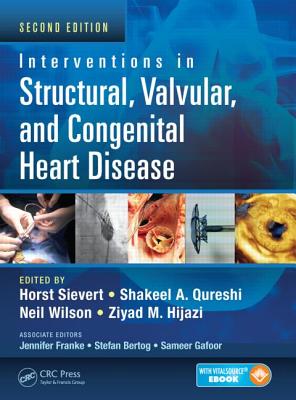 Interventions in Structural, Valvular and Congenital Heart Disease - Sievert, Horst (Editor), and Qureshi, Shakeel A. (Editor), and Wilson, Neil (Editor)