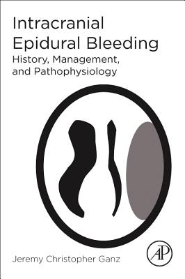 Intracranial Epidural Bleeding: History, Management, and Pathophysiology - Ganz, Jeremy Christopher