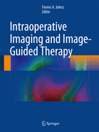 Intraoperative Imaging and Image-Guided Therapy