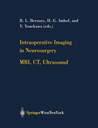 Intraoperative Imaging in Neurosurgery: Mri, Ct, Ultrasound - Bernays, R L (Editor), and Imhof, H -G (Editor), and Yonekawa, Y (Editor)