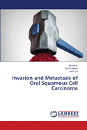 Invasion and Metastasis of Oral Squamous Cell Carcinoma