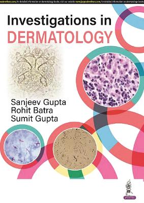Investigations in Dermatology - Gupta, Sanjeev, and Batra, Rohit, and Gupta, Sumit