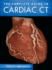 Complete Guide to Cardiac Ct