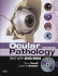 Ocular Pathology Text With Dvd-Rom, 6/Edb (**)
