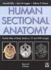 Human Sectional Anatomy: Pocket Atlas of Body Sections, Ct and Mri Images (an Arnold Publication)
