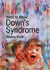 Down's Syndrome