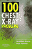 100 Chest X-Ray Problems, 1e