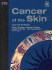 Cancer of the Skin