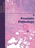 Prostate Pathology