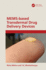 Mems-Based Transdermal Drug Delivery