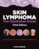 Skin Lymphoma: the Illustrated Guide