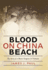 Blood on China Beach: My Story as a Brain Surgeon in Vietnam