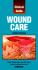 Wound Care