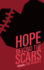 Hope Beyond the Scars
