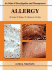 Allergy: an Atlas of Investigation and Diagnosis