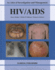 Hiv/Aids: an Atlas of Investigation and Management