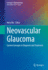 Neovascular Glaucoma