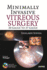 Minimally Invasive Vitreous Surgery: 20 Gauge to 27 Gauge