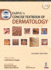 Iadvl's Concise Textbook of Dermatology