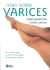 Todo Sobre Varices/ Everything About Varicose Veins: Como Prevenirlas, Como Curarlas/ How to Prevent Them, How to Cure Them