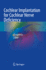 Cochlear Implantation for Cochlear Nerve Deficiency (Pb 2022)