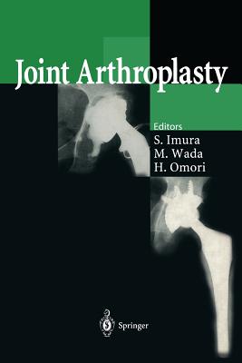 Joint Arthroplasty - Imura, Shinichi (Editor), and Wada, Makoto (Editor), and Omori, Hironori (Editor)