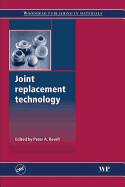 Joint Replacement Technology