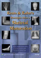 Keats and Kahn's Roentgen Atlas of Skeletal Maturation